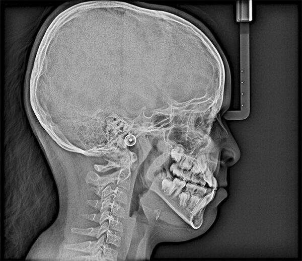 SISTEMA DE RADIOLOGÍA 2D/3D EXTRAORAL CARESTREAM CS 8100 SC 3D - Imagen 12