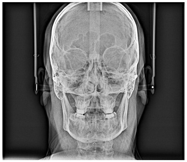 SISTEMA DE RADIOLOGÍA 2D/3D EXTRAORAL CARESTREAM CS 8100 SC 3D - Imagen 13
