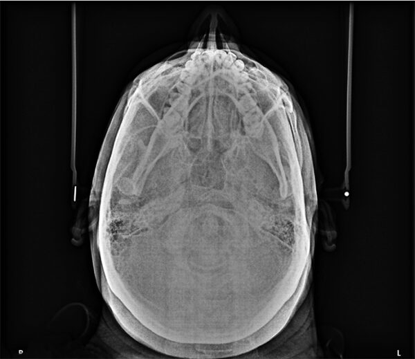 SISTEMA DE RADIOLOGÍA 2D/3D EXTRAORAL CARESTREAM CS 8100 SC 3D - Imagen 14