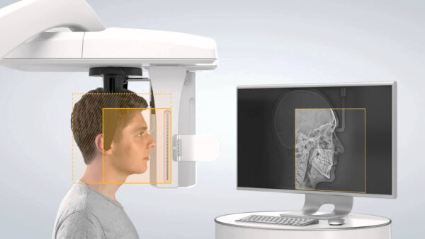 SISTEMA DE RADIOLOGÍA 2D/3D EXTRAORAL CARESTREAM 8100 3D - Imagen 2