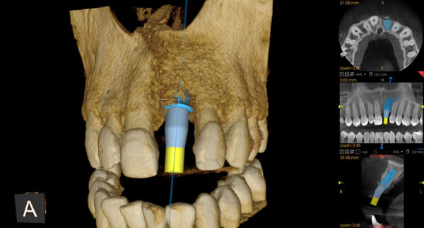 SISTEMA DE RADIOLOGÍA 2D/3D EXTRAORAL CARESTREAM CS 8100 SC 3D - Imagen 9