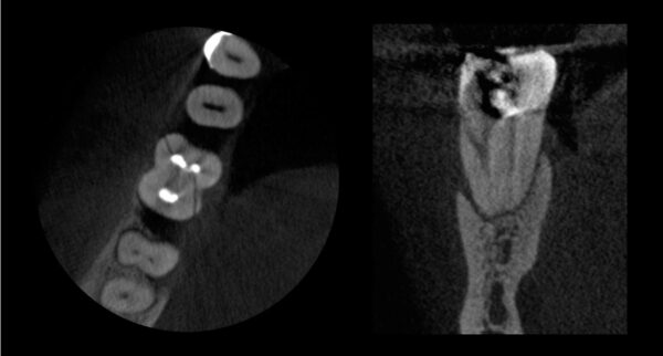 SISTEMA DE RADIOLOGÍA 2D/3D EXTRAORAL CARESTREAM CS 8100 SC 3D - Imagen 8
